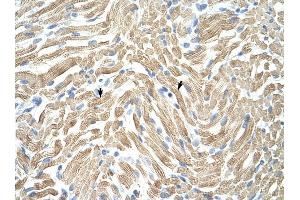 Tropomyosin 1 antibody was used for immunohistochemistry at a concentration of 4-8 ug/ml to stain Skeletal muscle cells (arrows) in Human Muscle. (Tropomyosin Antikörper)