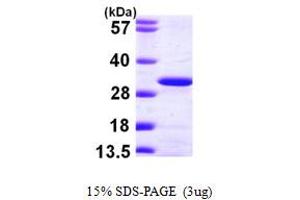Ubiquitin-Conjugating Enzyme E2K (UBE2K) (AA 1-200) protein (His tag)