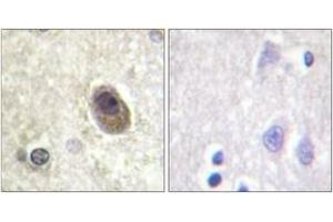 Immunohistochemistry analysis of paraffin-embedded human brain, using BAD (Phospho-Ser134) Antibody. (BAD Antikörper  (pSer134))