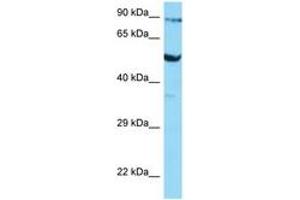 Image no. 1 for anti-Solute Carrier Family 2 (Facilitated Glucose Transporter), Member 3 (SLC2A3) (AA 181-230) antibody (ABIN6748398) (SLC2A3 Antikörper  (AA 181-230))