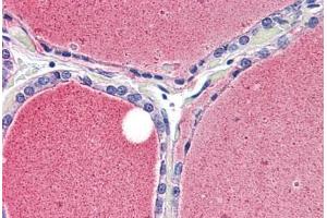 Immunohistochemistry (IHC) image for anti-Potassium Voltage-Gated Channel, Shaker-Related Subfamily, Member 3 (KCNA3) (C-Term) antibody (ABIN1048981)