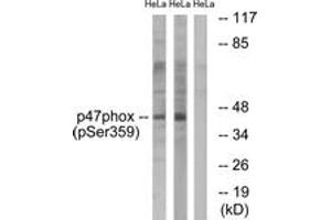 Western blot analysis of extracts from HeLa cells treated with nocodazole 1ug/ml 18h, using p47 phox (Phospho-Ser359) Antibody. (NCF1 Antikörper  (pSer359))