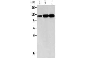 Western Blotting (WB) image for anti-Heat Shock 105kDa/110kDa Protein 1 (HSPH1) antibody (ABIN2421692) (HSPH1 Antikörper)
