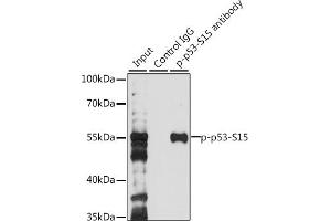 Immunoprecipitation analysis of 200 μg extracts of 293T cells, using 3 μg Phospho-p53-S15 pAb (ABIN3023600, ABIN3023601, ABIN3023602 and ABIN6225458). (p53 Antikörper  (pSer15))