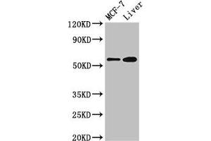 Western Blot Positive WB detected in: MCF-7 whole cell lysate, Mouse liver tissue All lanes: CBS antibody at 2. (CBS Antikörper  (AA 1-413))