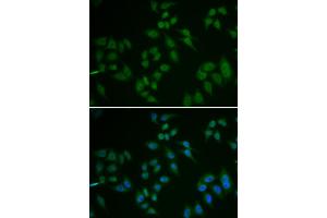 Immunofluorescence analysis of U2OS cells using TP63 antibody (ABIN5971164). (p63 Antikörper)