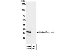 Western Blotting (WB) image for anti-Troponin I (TNNI) antibody (ABIN7795609) (Troponin I Antikörper)
