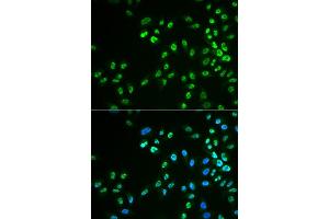 Immunofluorescence analysis of HeLa cell using DDX41 antibody. (DDX41 Antikörper)