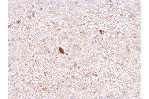 Formalin-fixed, paraffin-embedded human Brain stained with Serum Amyloid P Mouse Monoclonal Antibody (APCS/3240). (APCS Antikörper  (AA 143-223))