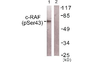 Western blot analysis of extracts from NIH/3T3cells, using c-RAF (Phospho-Ser43) antibody. (RAF1 Antikörper  (pSer43))
