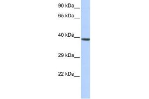 WB Suggested Anti-HOXA2 Antibody Titration:  0. (HOXA2 Antikörper  (Middle Region))