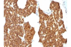 Formalin-fixed, paraffin-embedded human Parathyroid Gland stained with PTH Rabbit Polyclonal Antibody. (PTH Antikörper  (AA 1-115))