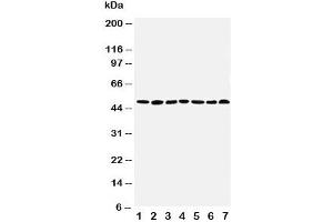 Western blot testing of CtBP1 antibody and Lane 1:  rat brain (CTBP1 Antikörper  (AA 425-440))