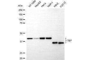 Western blotting analysis using TBP antibody (ABIN7800515).
