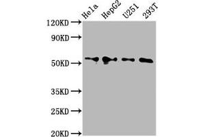 Western Blot Positive WB detected in: Hela whole cell lysate, HepG2 whole cell lysate, U251 whole cell lysate, 293T whole cell lysate All lanes: CCT6A antibody at 4. (CCT6A Antikörper  (AA 80-250))
