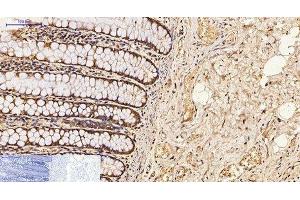Immunohistochemistry of paraffin-embedded Human colon tissue using CDX2 Monoclonal Antibody at dilution of 1:200.