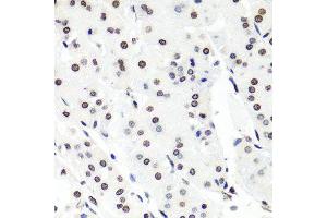 Immunohistochemistry of paraffin-embedded human stomach using HIST1H2BG antibody (ABIN6003628) at dilution of 1/100 (40x lens). (HIST1H2BG Antikörper)