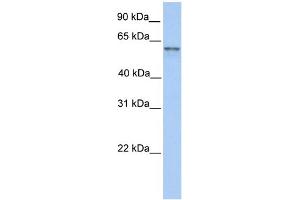 WB Suggested Anti-FAM13C1 Antibody Titration: 0. (FAM13C Antikörper  (N-Term))