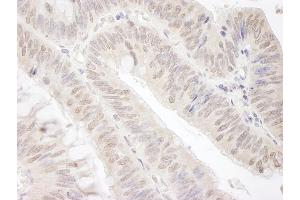 Immunohistochemistry (IHC) image for anti-Gem (Nuclear Organelle) Associated Protein 4 (GEMIN4) (C-Term) antibody (ABIN7448579)