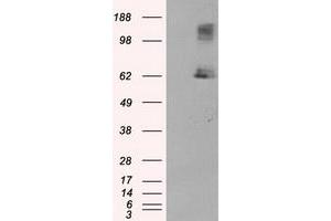 HEK293T cells were transfected with the pCMV6-ENTRY control (Left lane) or pCMV6-ENTRY LIPG (Right lane) cDNA for 48 hrs and lysed. (LIPG Antikörper)