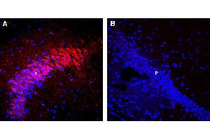 Expression of nAChRα7 in mouse hippocampusImmunohistochemical staining of perfusion-fixed frozen mouse brain sections with Guinea Pig Anti-Nicotinic Acetylcholine Receptor α7 (CHRNA7) (extracellular) Antibody (ABIN7581857), (1:300), followed by goat anti-guinea pig-Alexa-594. (Cholinergic Receptor, Nicotinic, alpha 7 (Neuronal) (CHRNA7) Peptid)