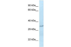 WB Suggested Anti-Sult1c2 Antibody Titration: 1. (SULT1C2 Antikörper  (Middle Region))