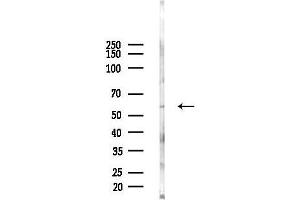 anti-Copine I (CPNE1) (C-Term) antibody