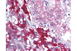 Anti-RPAIN antibody IHC of human adrenal. (RPAIN Antikörper  (C-Term))