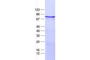 Validation with Western Blot