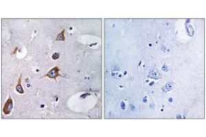 Immunohistochemistry analysis of paraffin-embedded human brain tissue, using CHSY1 antibody. (CHSY1 Antikörper  (Internal Region))