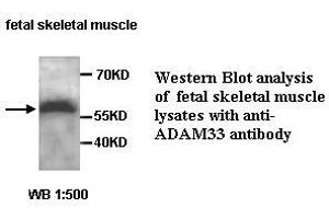 Image no. 1 for anti-ADAM Metallopeptidase Domain 33 (ADAM33) antibody (ABIN1574465) (ADAM33 Antikörper)
