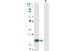 Western Blot analysis of XAGE2 expression in transfected 293T cell line by XAGE2 monoclonal antibody (M12), clone 4C4. (XAGE2 Antikörper  (AA 44-111))
