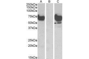 HEK293 lysate (10 µg protein in RIPA buffer) overexpressing Human EPM2AIP1 with DYKDDDDK tag probed with EPM2AIP1 Antibody (1 µg/ml) in Lane A and probed with anti-DYKDDDDK Tag (1/1000) in lane C.