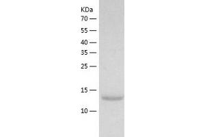 Placenta Growth Factor (PGF) (AA 24-158) protein (His-IF2DI Tag)