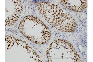 Immunoperoxidase of monoclonal antibody to KIF2 on formalin-fixed paraffin-embedded human testis. (KIF2A Antikörper  (AA 1-679))