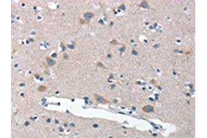 The image on the left is immunohistochemistry of paraffin-embedded Human brain tissue using ABIN7189813(ANP32C Antibody) at dilution 1/30, on the right is treated with synthetic peptide. (ANP32C Antikörper)