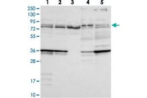 Western blot analysis of Lane 1: RT-4, Lane 2: U-251 MG, Lane 3: Human Plasma, Lane 4: Liver, Lane 5: Tonsil with KATNB1 polyclonal antibody  at 1:250-1:500 dilution.