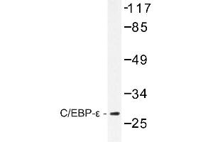 Image no. 1 for anti-CCAAT/enhancer Binding Protein (C/EBP), epsilon (CEBPE) antibody (ABIN272198) (CEBPE Antikörper)