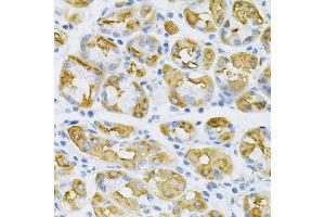Immunohistochemistry of paraffin-embedded human stomach using SDC4 Antibody (ABIN5970935) at dilution of 1/100 (40x lens). (SDC4 Antikörper)