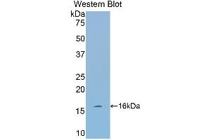 Western Blotting (WB) image for anti-Tryptase alpha/beta 1 (TPSAB1) (AA 149-273) antibody (ABIN1174174) (TPSAB1 Antikörper  (AA 149-273))