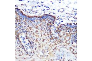 Immunohistochemistry of paraffin-embedded human esophageal using  Rabbit mAb (ABIN7265589) at dilution of 1:100 (40x lens). (Angiopoietin 2 Antikörper)