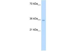 ATIC antibody - middle region  validated by WB using Jurkat cell lysate at 5. (ATIC Antikörper  (Middle Region))