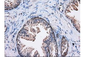 Immunohistochemical staining of paraffin-embedded Human liver tissue using anti-TBXAS1 mouse monoclonal antibody. (TBXAS1 Antikörper)