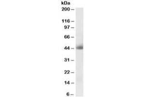 Western blot testing of human kidney lysate with CA12 antibody at 0. (CA12 Antikörper)