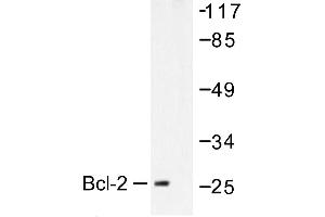 Image no. 1 for anti-B-Cell CLL/lymphoma 2 (BCL2) antibody (ABIN271996) (Bcl-2 Antikörper)