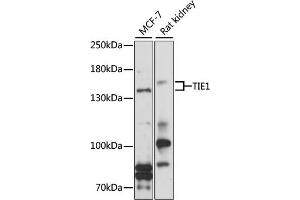 Western blot analysis of extracts of various cell lines, using TIE1 antibody (ABIN1683033, ABIN3017717, ABIN3017718 and ABIN6220214) at 1:1000 dilution.