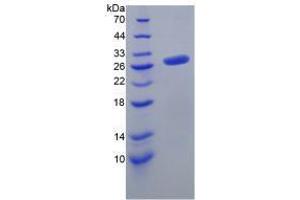 Image no. 1 for Fibroblast Growth Factor 23 (FGF23) (AA 25-251) (Active) protein (His tag) (ABIN6239859)