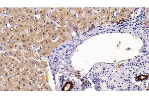 Immunohistochemistry (IHC) image for anti-Keratin 17 (KRT17) (AA 252-393) antibody (ABIN7434125)