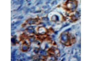 IHC-P analysis of Ovary tissue, with DAB staining. (CD70 Antikörper  (AA 47-191))