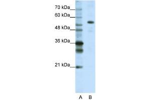 WB Suggested Anti-FLJ12529 Antibody Titration:  1. (CPSF7 Antikörper  (C-Term))